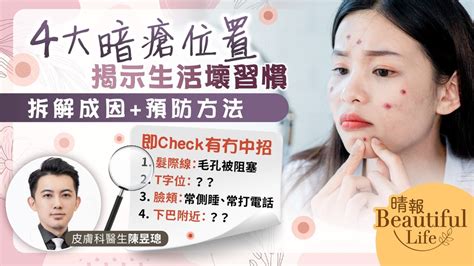 暗瘡位置|【暗瘡位置】不同代表什麼？中醫教如何處理及預防